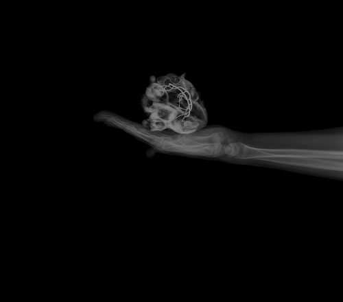 X-ray of a hand with a skull Description automatically generated
